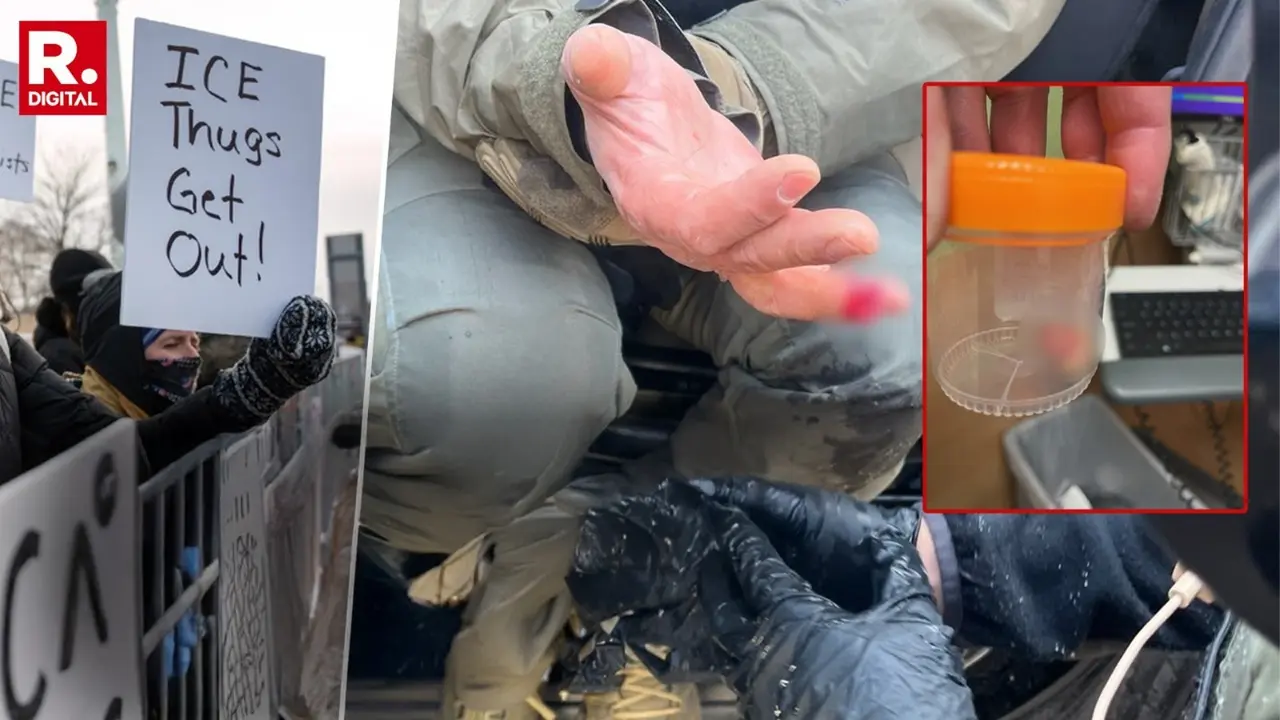 Anti-ICE Protests: Federal Officer's Finger Bitten Off Amid Alex Pretti Shooting Row