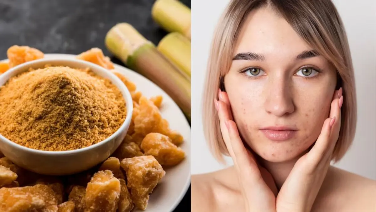 Anti Pigmentation Pack