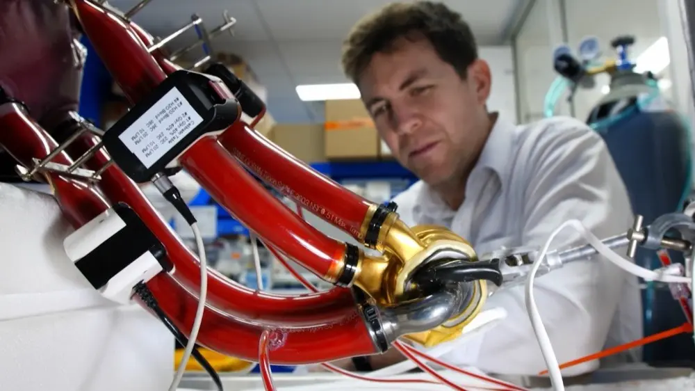Australian Man Becomes First to Live 100 Days with Titanium Artificial Heart