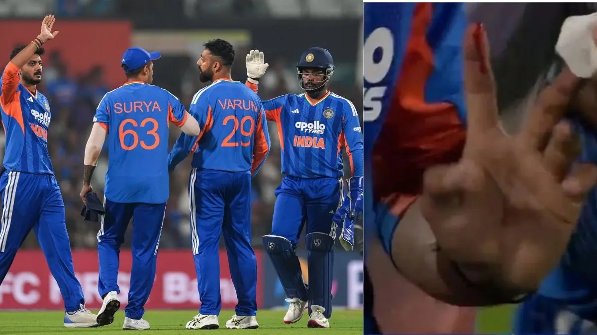 axar patel injured blood from finger in nagpur match ind vs nz 2nd t20 raipur