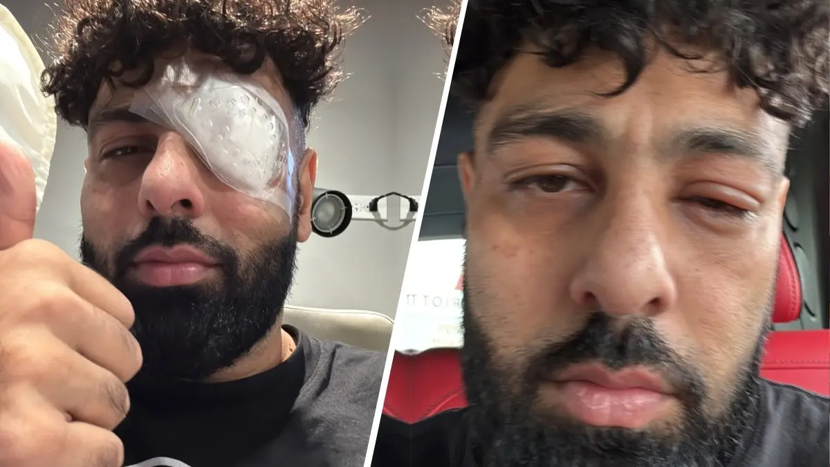 Badshah suffers eye injury