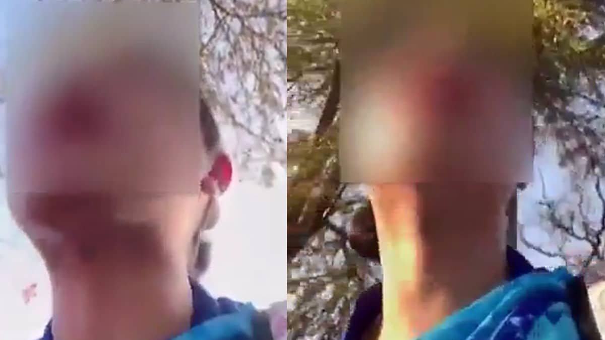 Bengaluru Woman Alleges Daylight Harassment By 'Naked Man' While Commuting From Work 