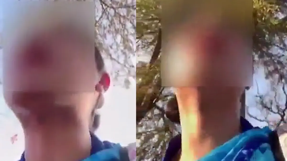 Bengaluru Woman Alleges Daylight Harassment By 'Naked Man' While Returning From Work, Bystanders Watched