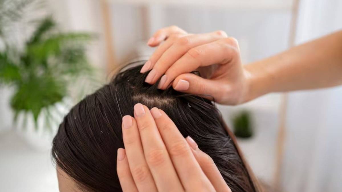 Description of the pic