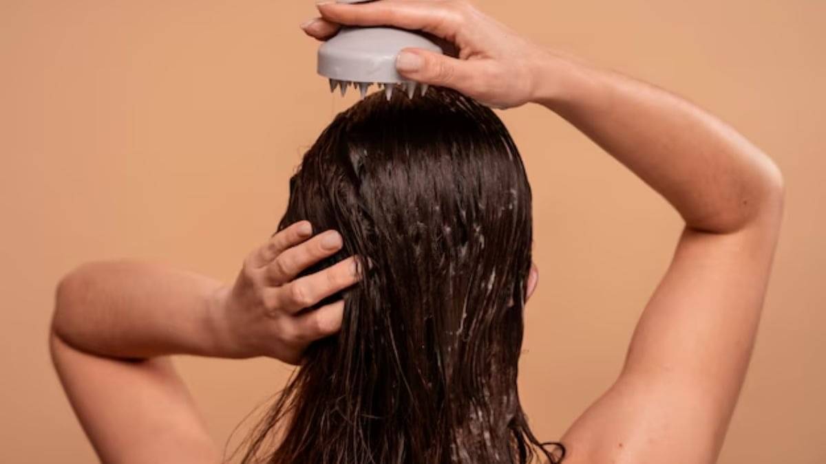 Description of the pic