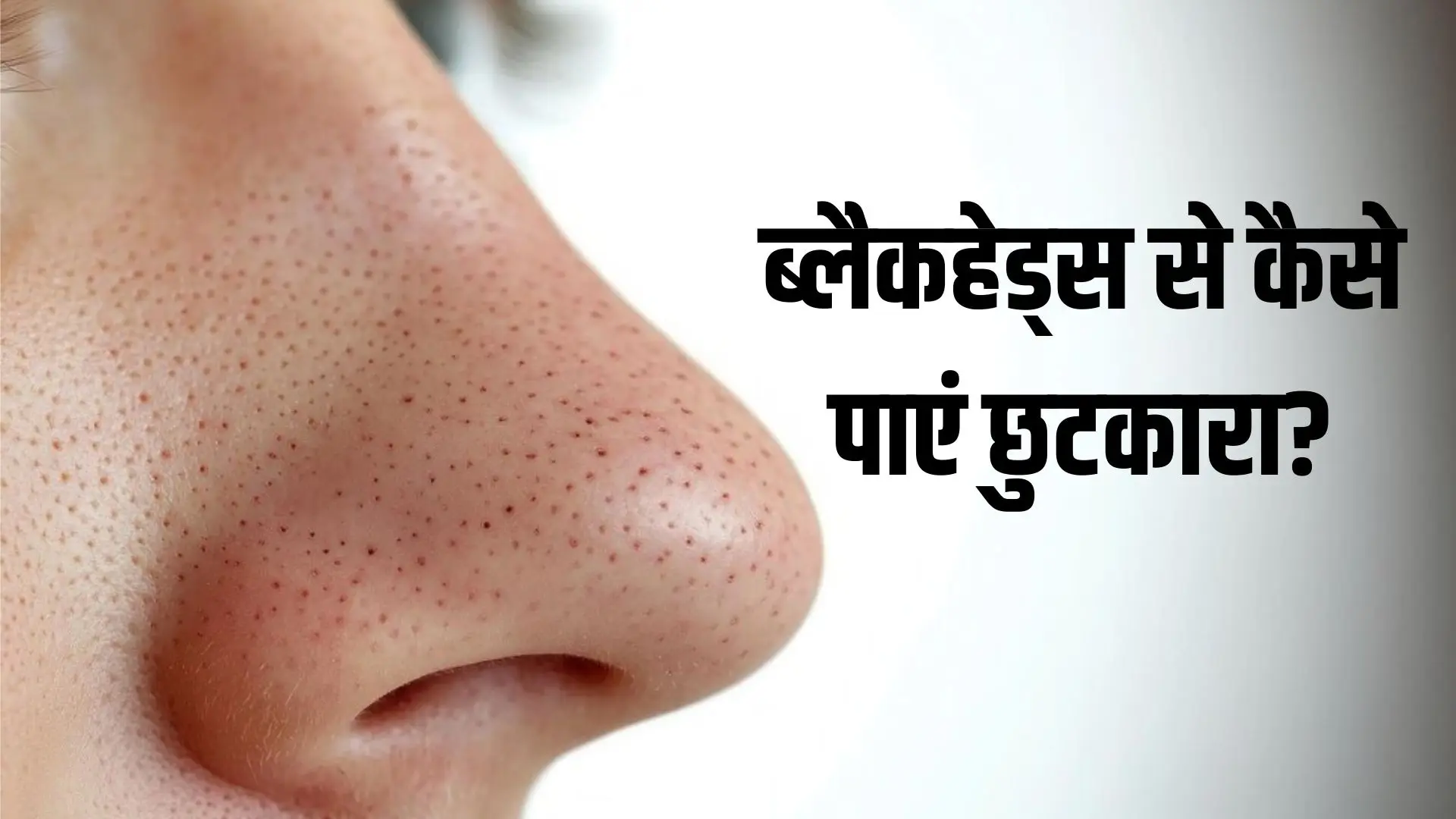 how to get rid of blackheads on nose using honey and coffee powder face scrub