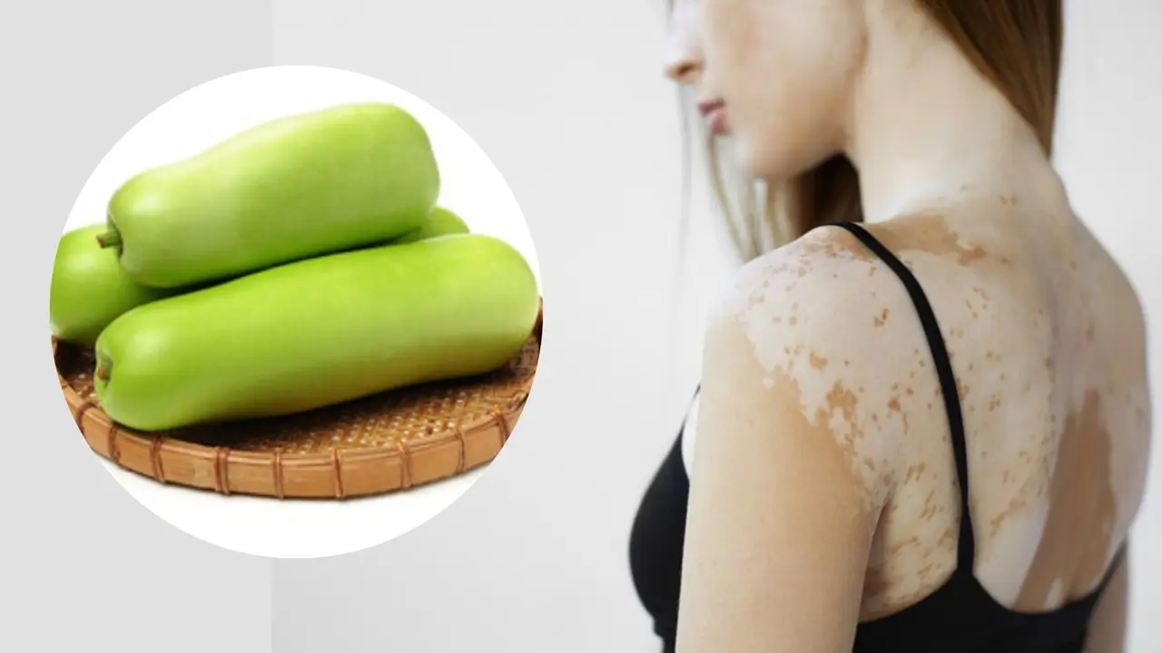 Bottle gourd side effects