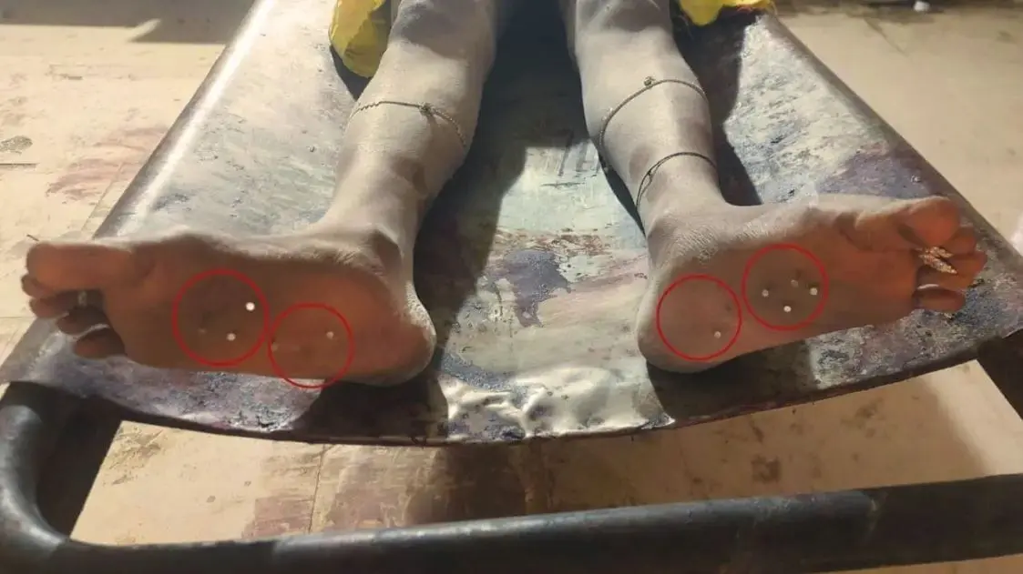 brutal murder of woman nails hammered in both her legs