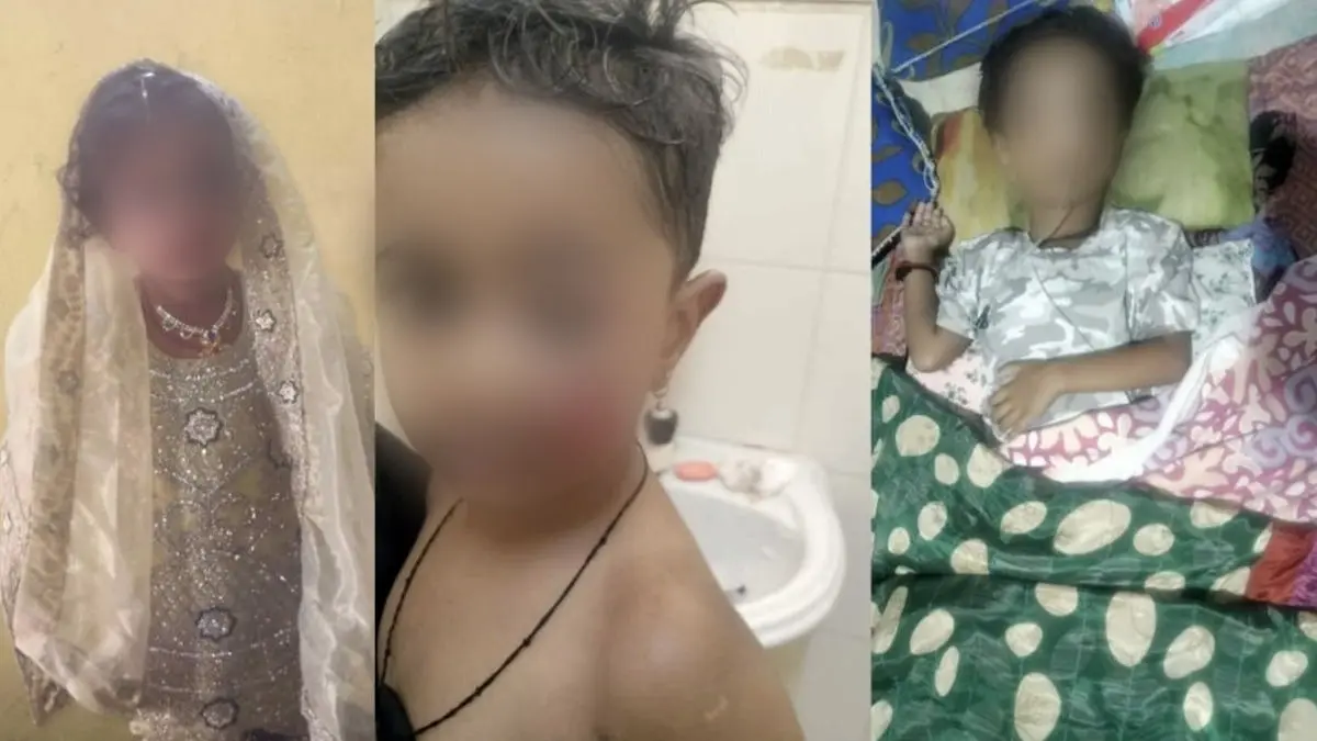 Caught On Camera: Horrifying Stray Dogs Attack 5-Year-Old Sparks Outrage in Udaipur