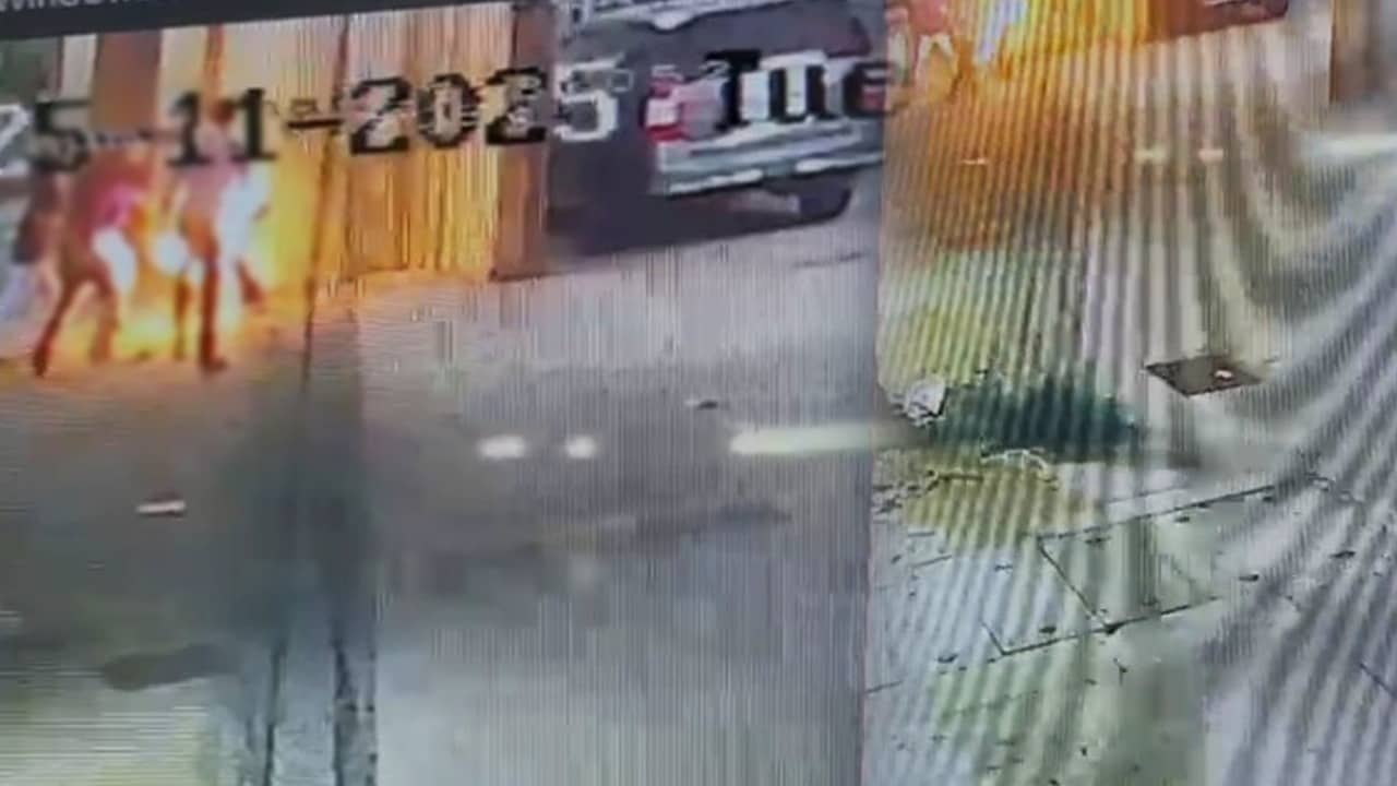 Student burnt alive by friends on birthday in Mumbai