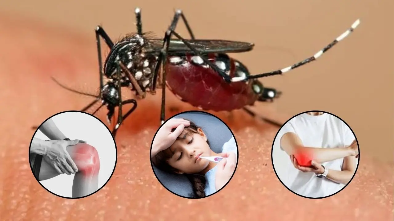 Chikungunya Fever: Causes, Symptoms, How It Spreads And More