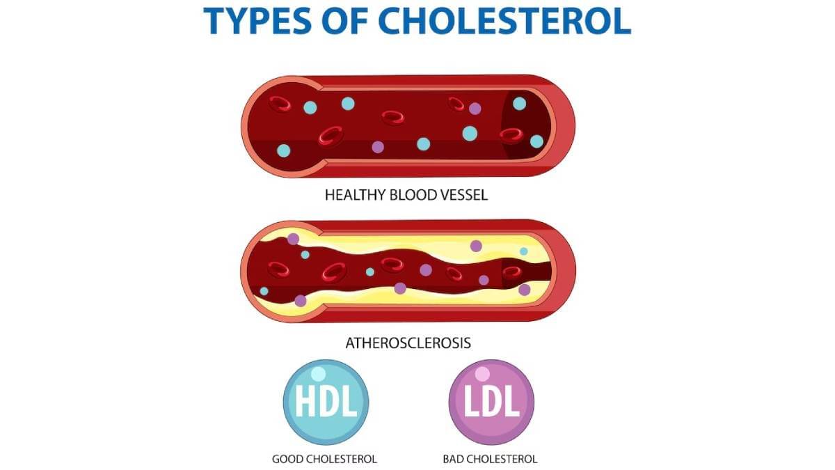 Description of the pic