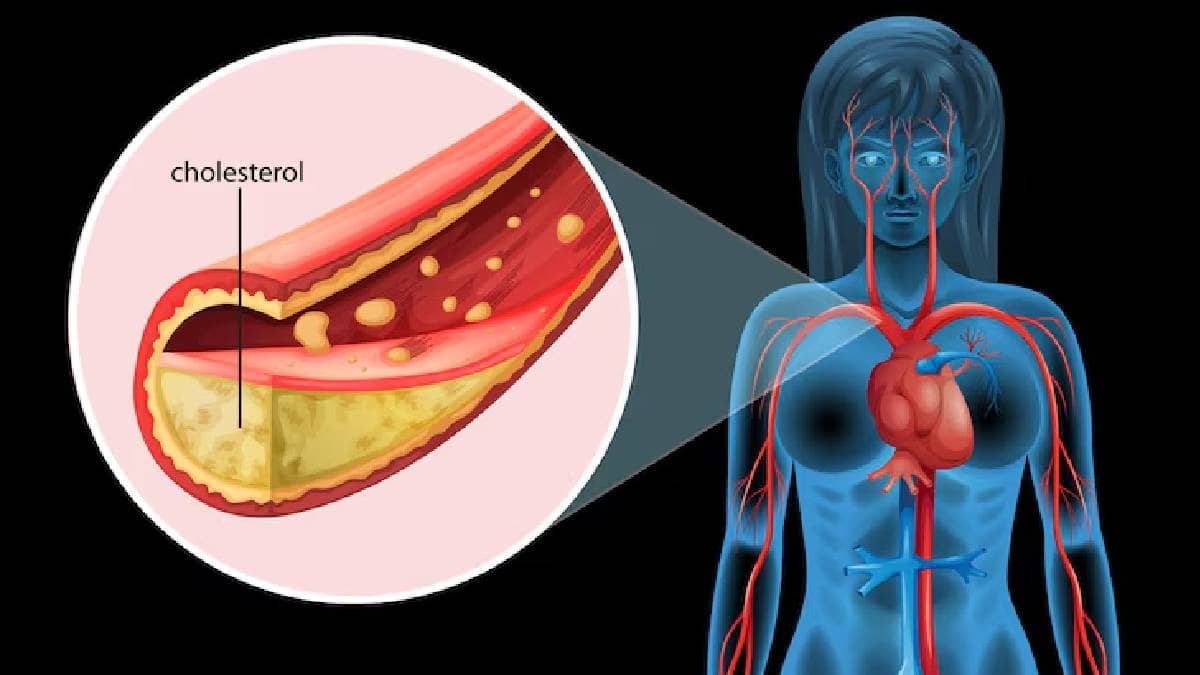 Description of the pic