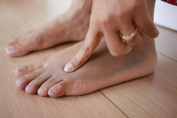 Description of the pic