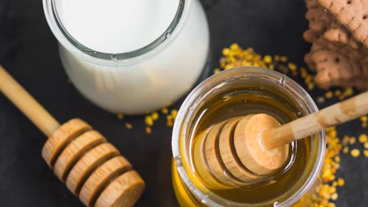 Description of the pic