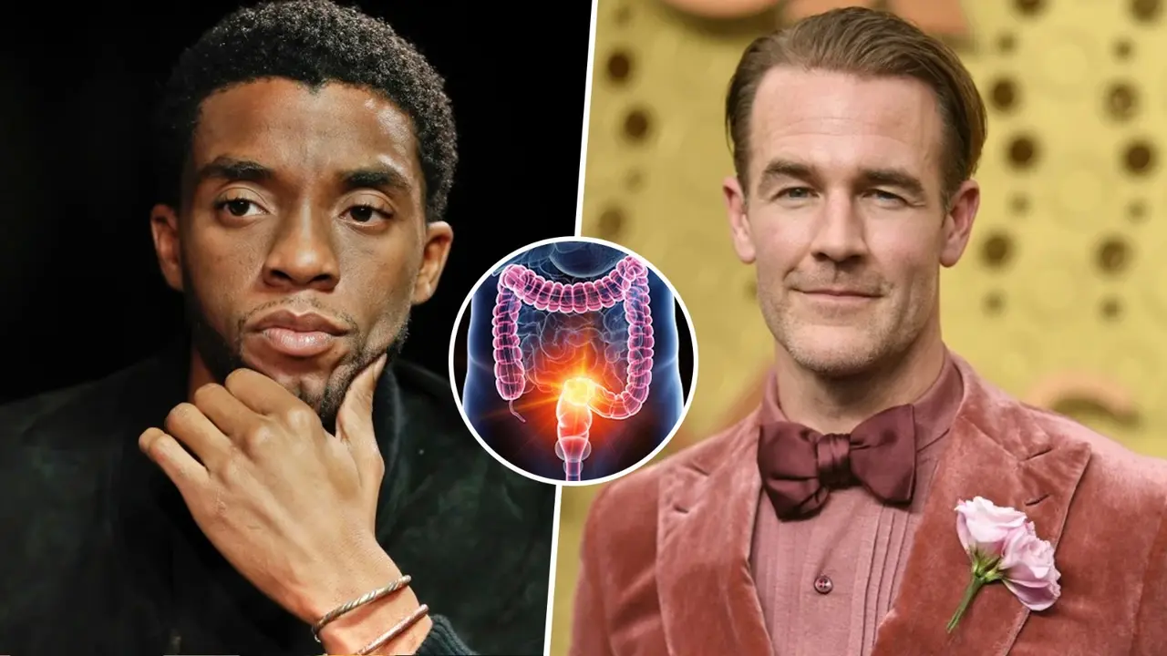 Colorectal Cancer: Here’s Who Is Most At Risk And Symptoms To Watch For Colorectal cancer is the second leading cancer killer in the US, behind lung cancer