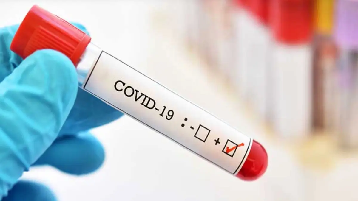 Covid, coronavirus