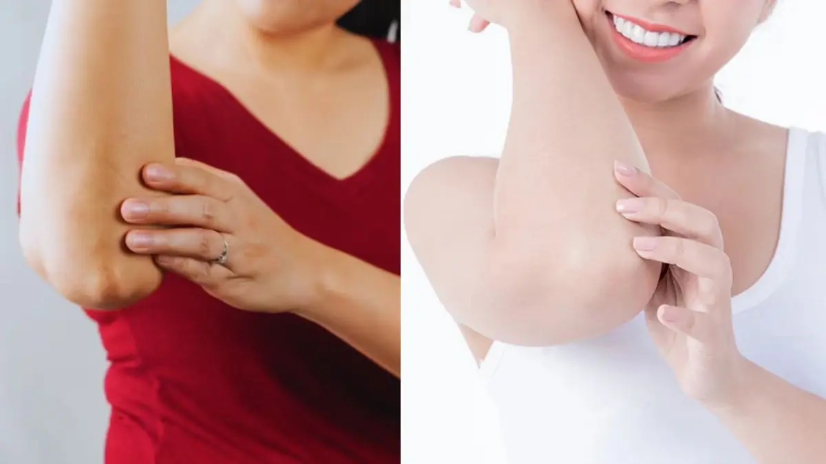 Dark Elbows and Knees: काली कोहनी और घुटनों पर जमे मैल से हैं परेशान, तो इन घरेलू उपायों से करें साफ, 2 दिनों में मिलेगी निखरी स्किन Dark Elbow Remedies