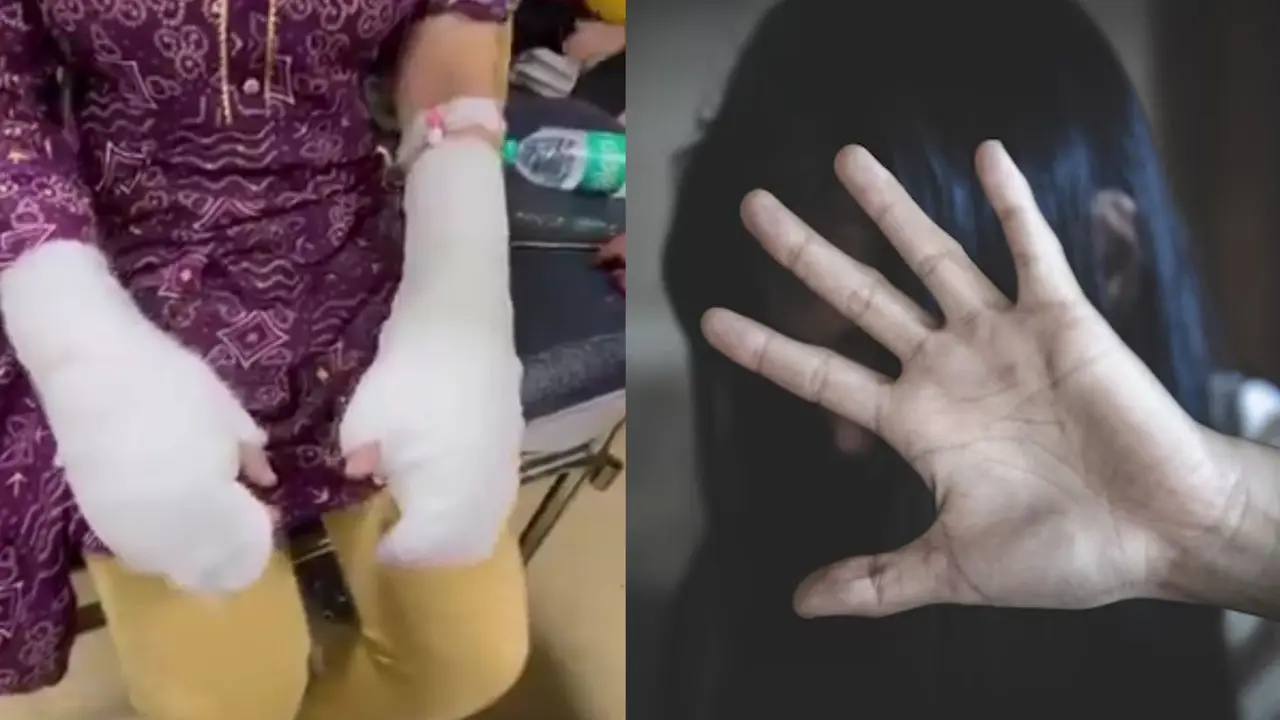 Delhi DU Student acid attack case