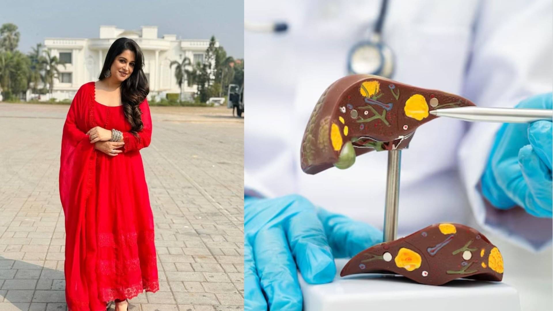 Description of the pic