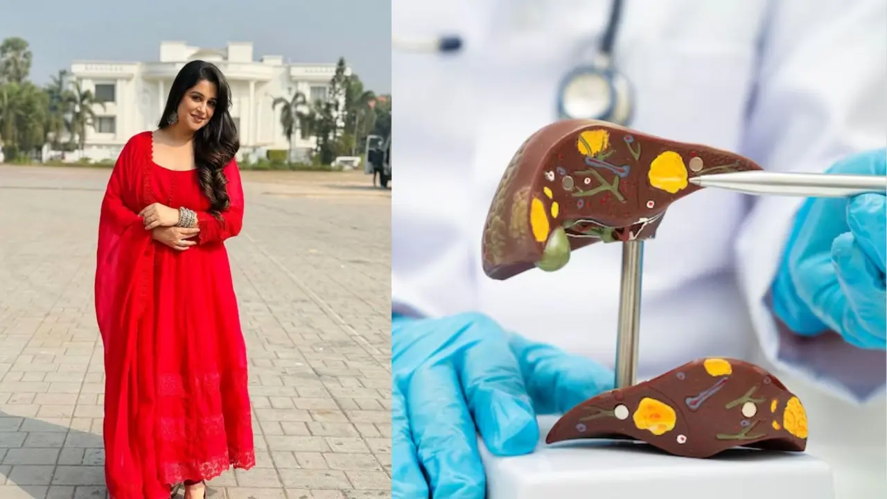 Dipika Kakar diagnosed with Liver Cancer