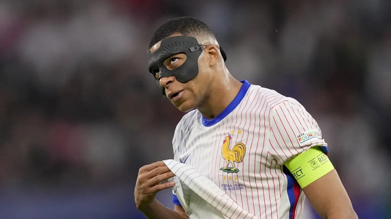 Kylian Mbappe's Nose Injury: Surgery Needed? Real Madrid Debut Date REPORTEDLY OUT Kylian Mbappe
