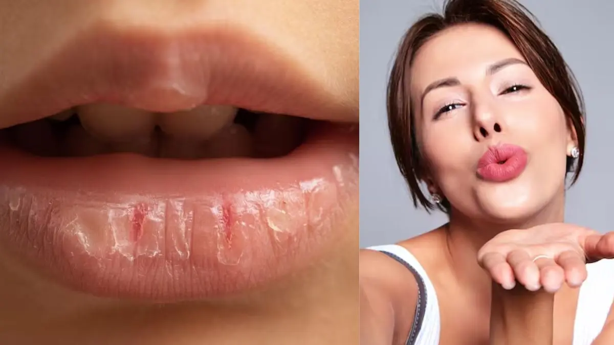 Dry Lips: सर्दी आते ही फटने लगे होंठ? इन 5 टिप्स की मदद से रखें होंठों का ख्याल, लिप्स दिखेंगे पिंक-पिंक easy tips to hydrate your dry lips and make them pink