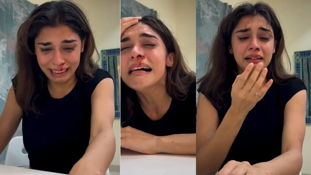 eisha singh viral crying video on social media blood from nose fans reaction