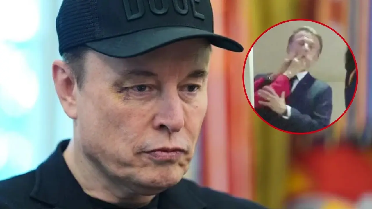 VIDEO: Elon Musk Breaks Silence on Mystery Bruise Near Right Eye, Pokes Fun at Macron Slap Scandal Elon Musk Breaks Silence on Mystery Bruise Near Right Eye, Pokes Fun at Macron Slap Scandal