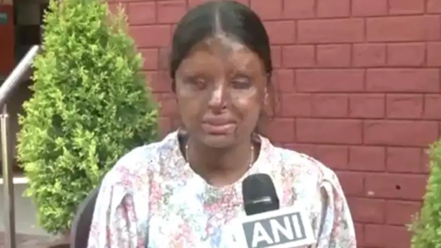 Acid Attack Survivor Tops 12 Boards: Shares Her Motivation And Dreams