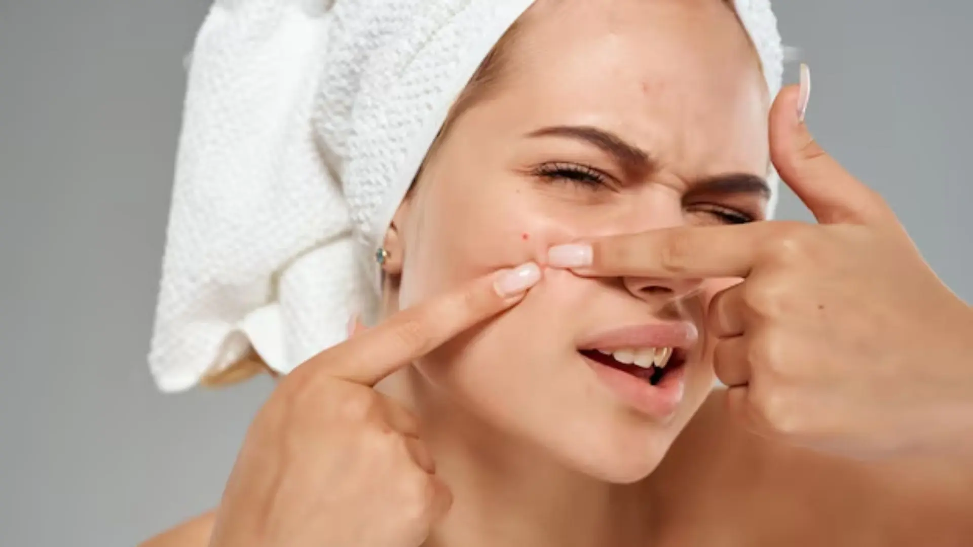 Face pack for pimple