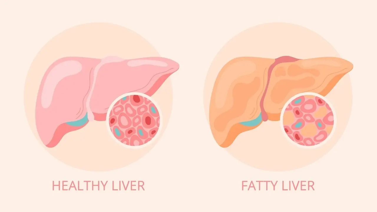 fatty liver diet in hindi