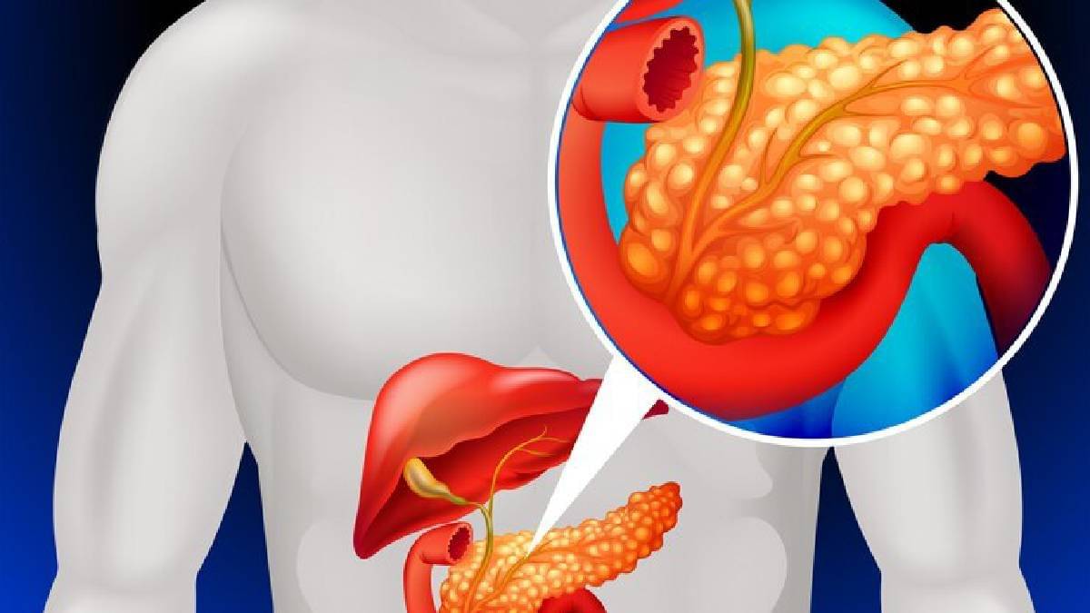 Description of the pic