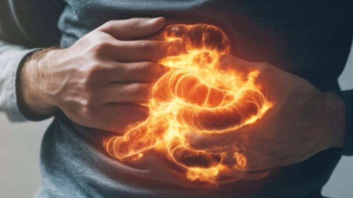 Gas and Acidity