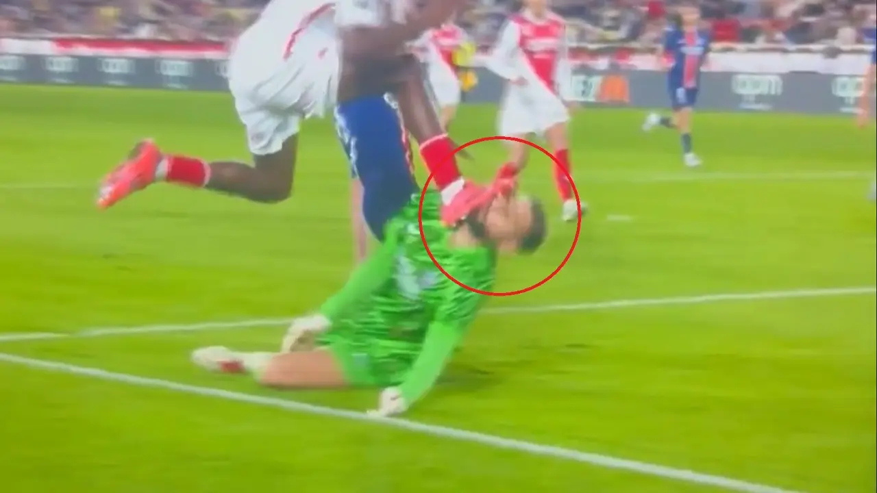 WATCH | When PSG Goalkeeper Donnarumma Got Brutally Hit On The Face By Wilfried Singo’s Cleat Gianluigi Donnarumma