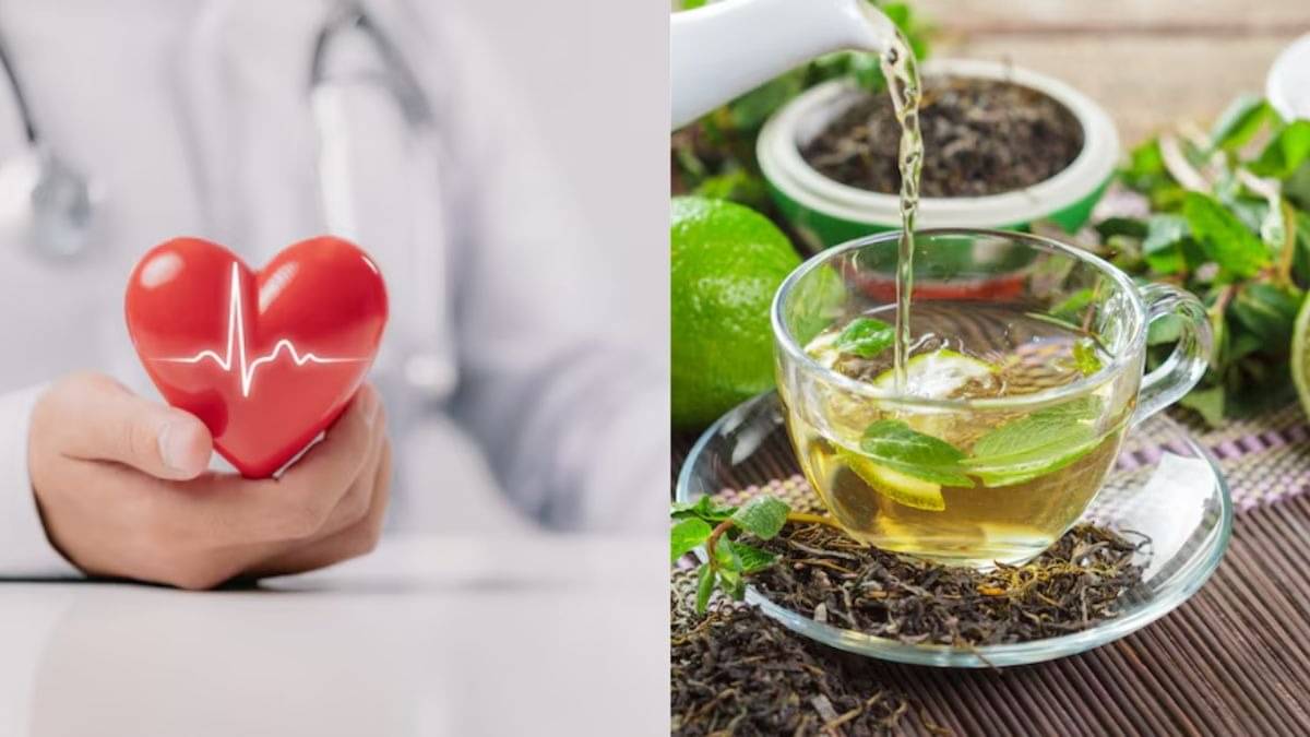 Description of the pic