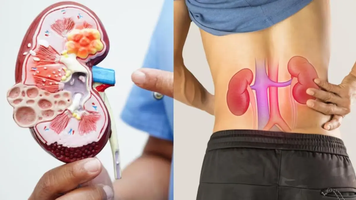 habits that can damage your kidney before time health tips to stay fit