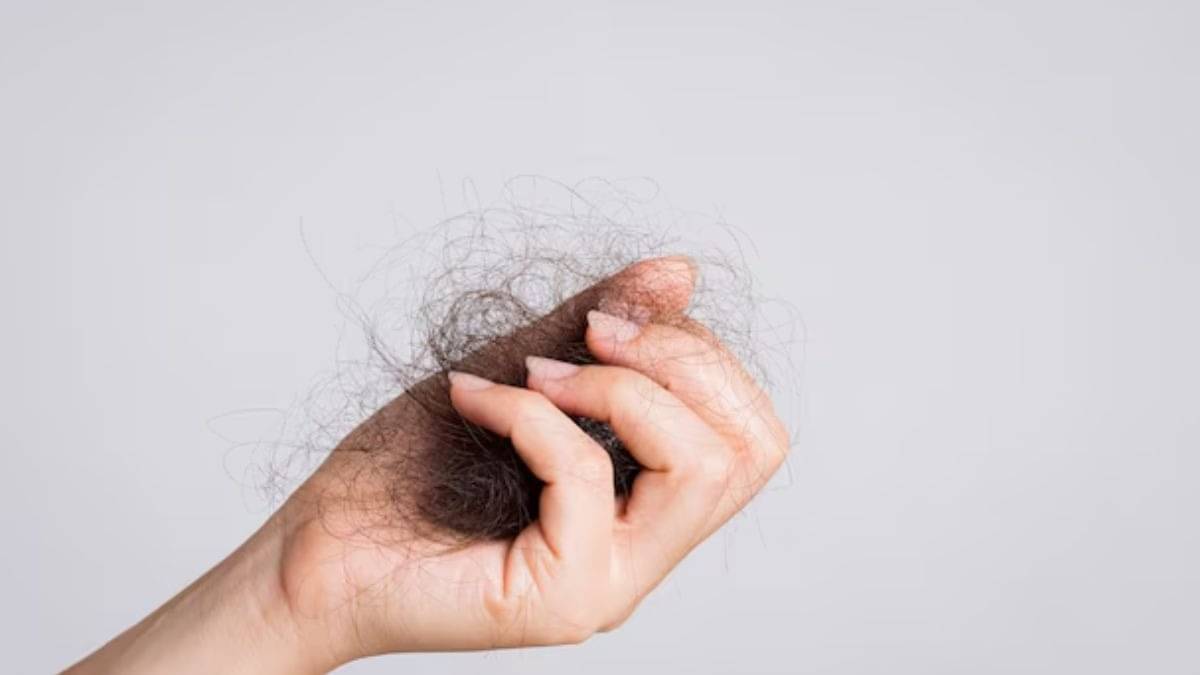 Description of the pic