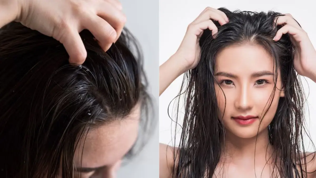 Hair Wash Tips: हेयरवॉश के बाद भी बाल हो रहे हैं तेल जैसे चिपचिपे, इन घरेलू उपायों को जरूर आजमाएं Hair Wash Tips
