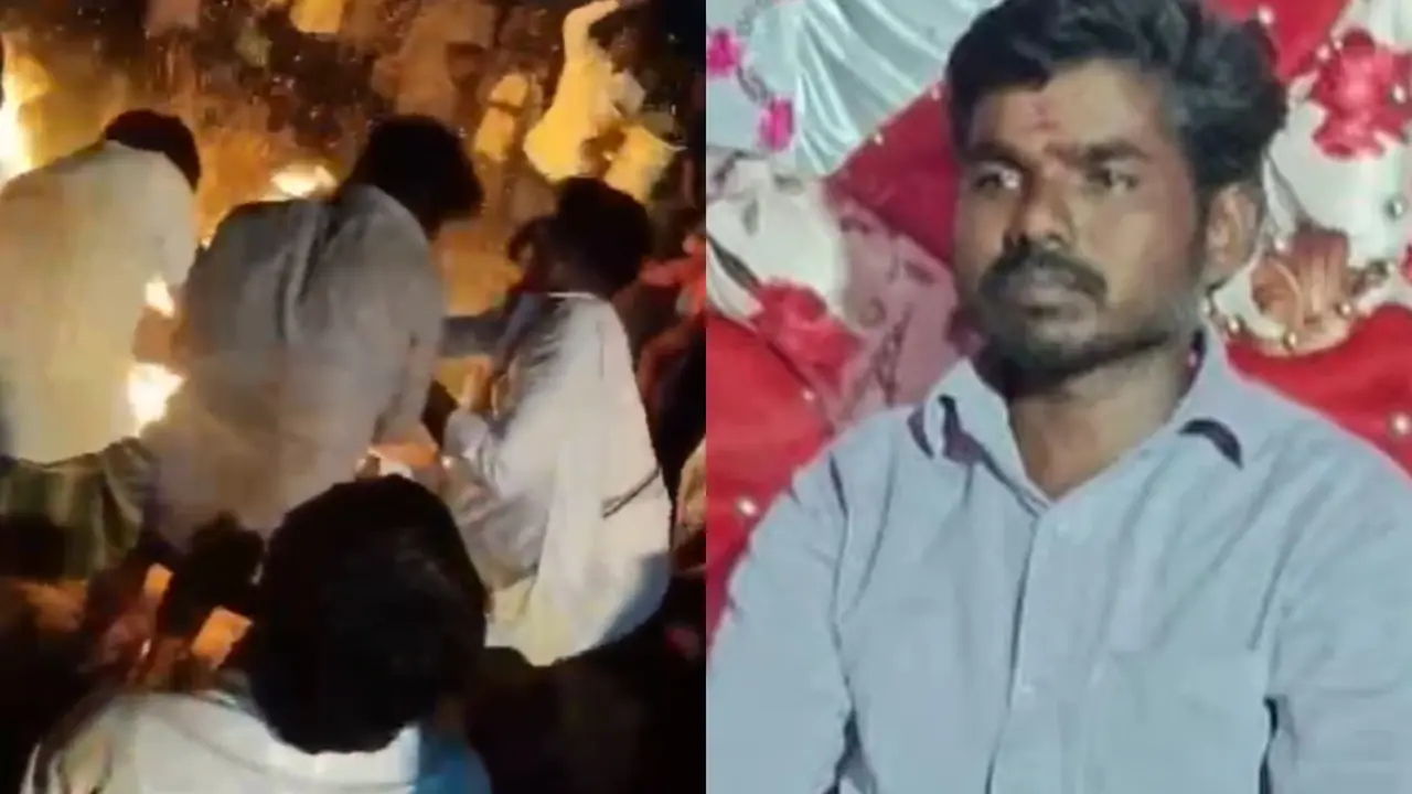 Hanumanth Died After Severe Burn Injuries