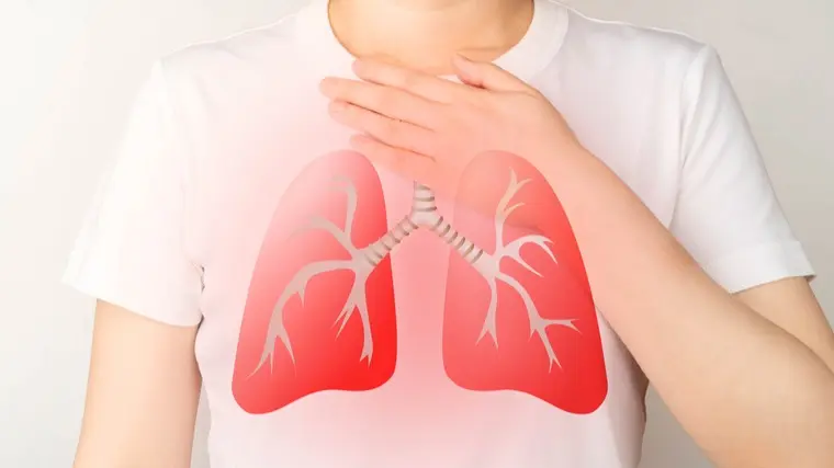 Healthcare workers at higher risk of Tuberculosis