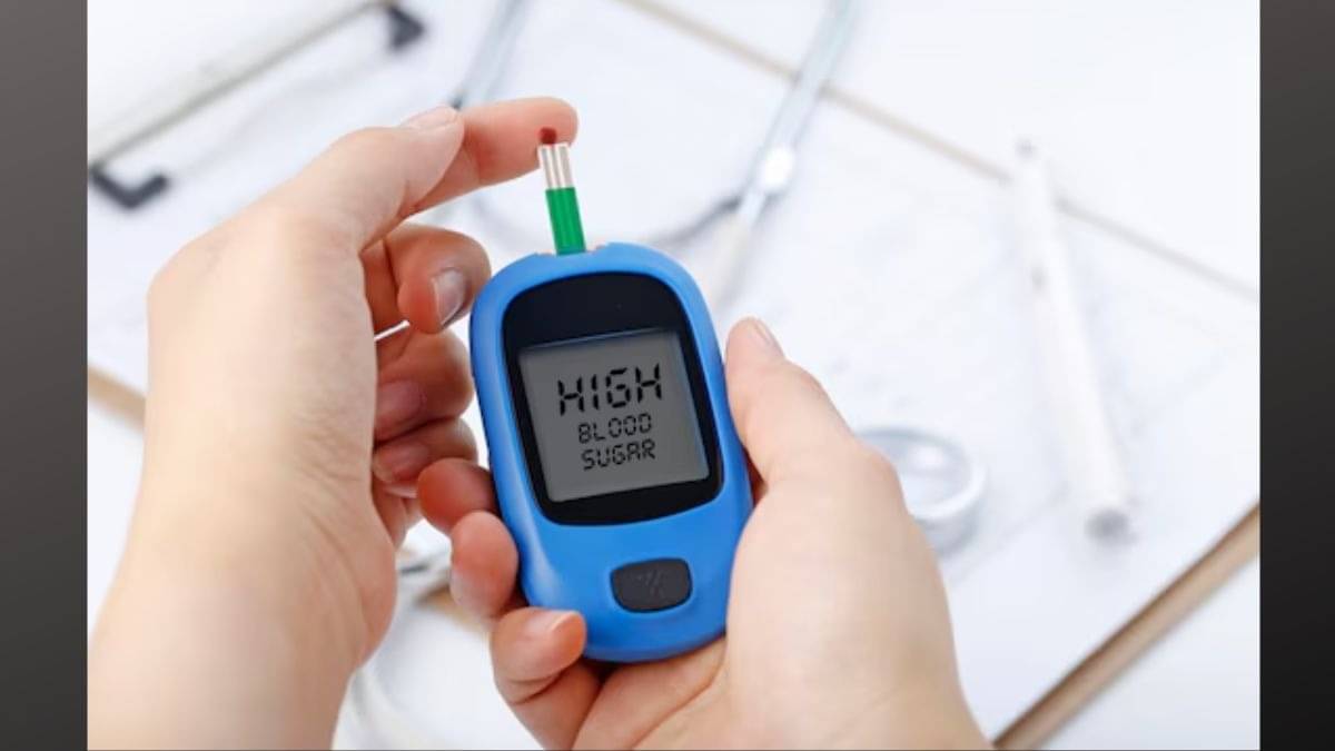 Description of the pic