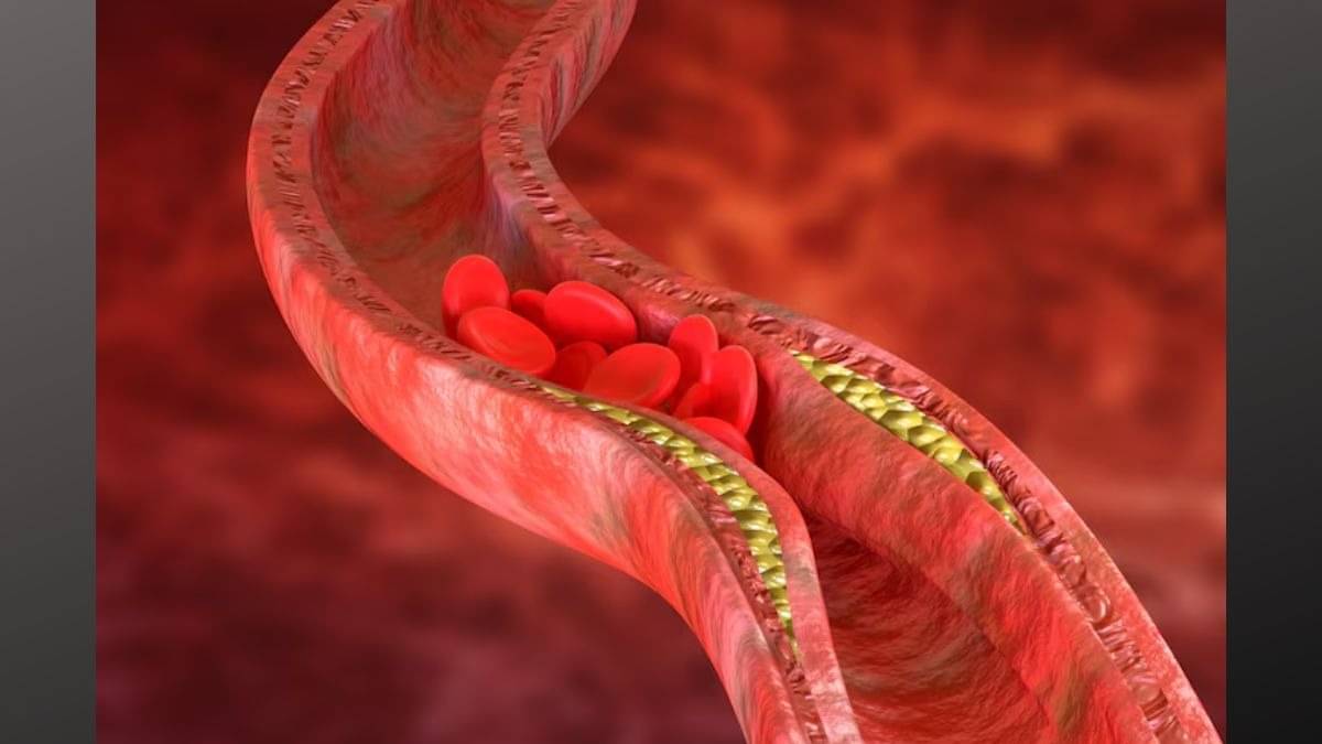 Description of the pic