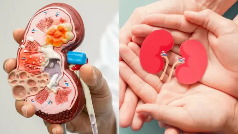 Kidney Problem: आज ही से अपनाएं ये 5 आदतें, किडनी की बीमारियों से रहेंगे कोसों दूर healthy habits to protect kidney from damage disease free fitness tips