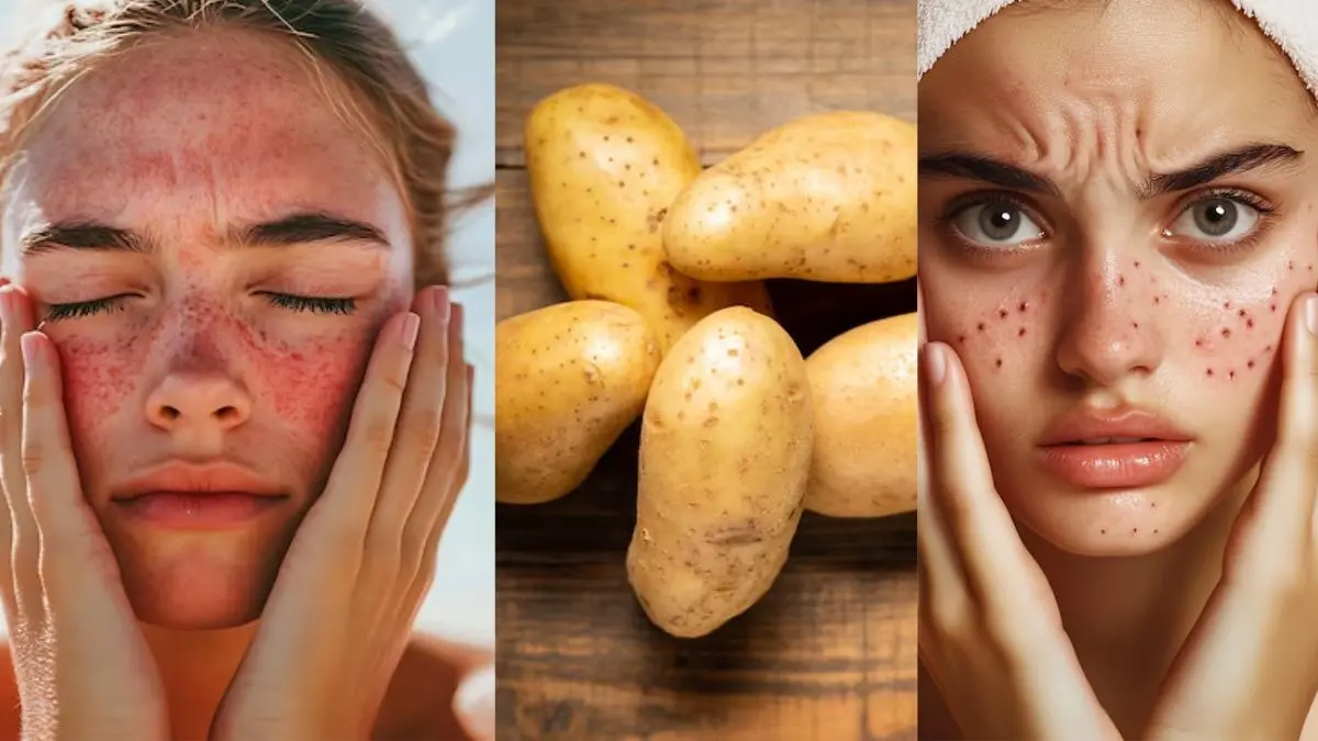 Healthy Skin Care: आप भी सनबर्न और दाग-धब्बों से हैं परेशान? ये सब्जी है इसके लिए रामबाण, 2 हफ्ते में दिख जाएगा फर्क Healthy Skin Care