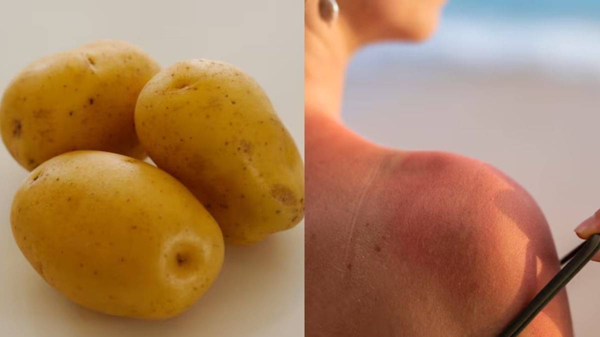 Description of the pic