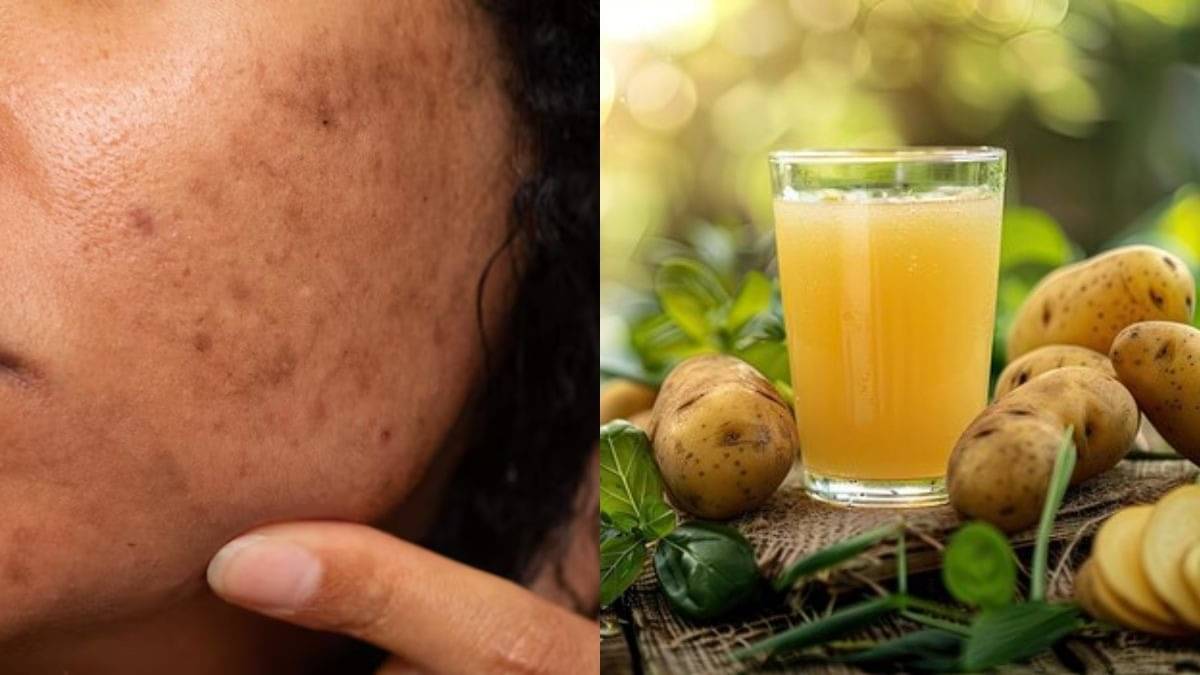 Description of the pic