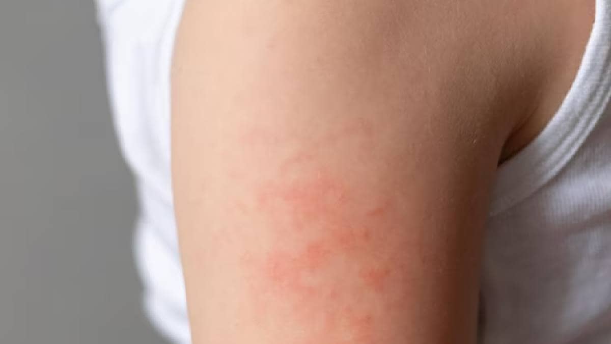 Description of the pic