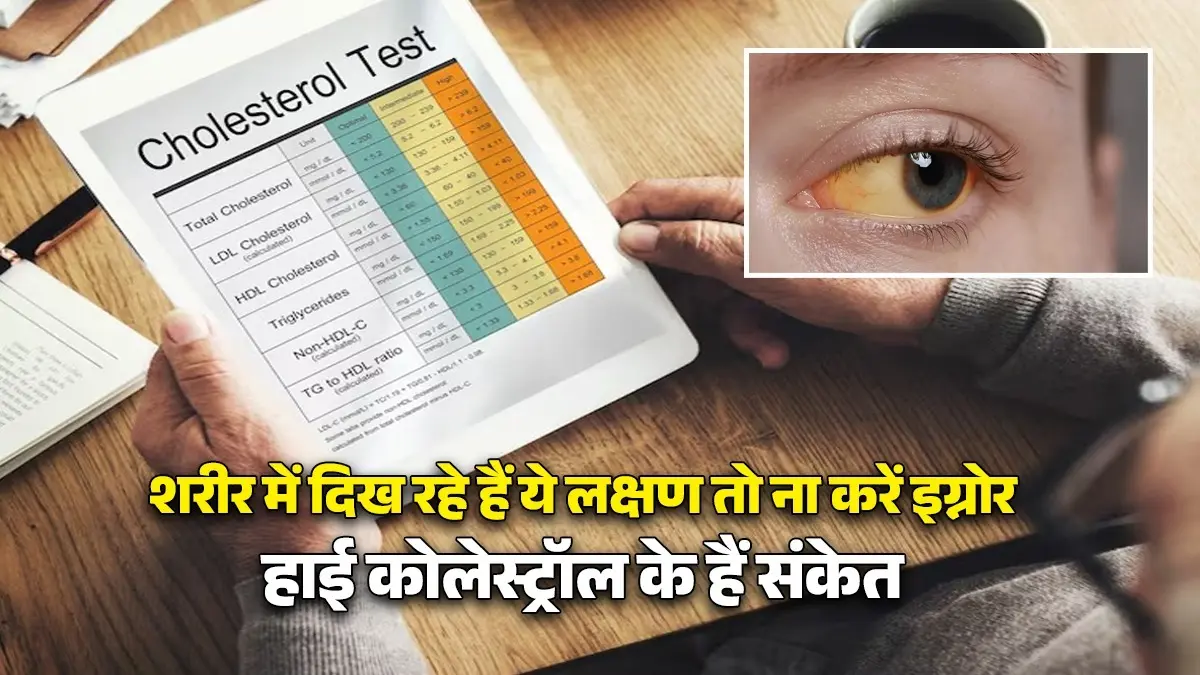 High Cholesterol Symptoms