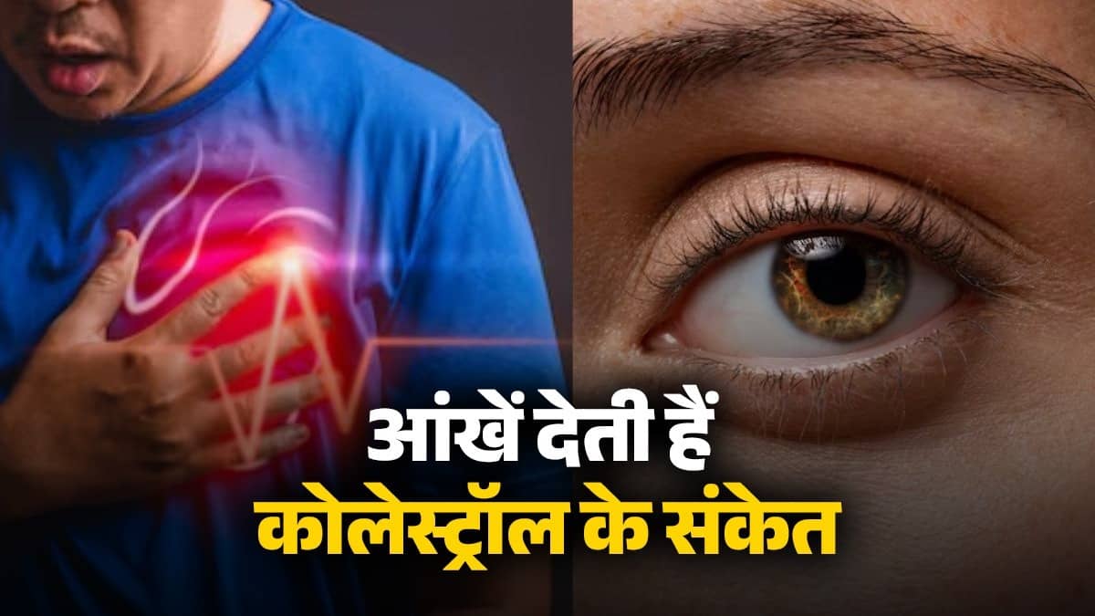 high-cholesterol-symptoms-in-eye-signs-to-control-heart-attack-risk